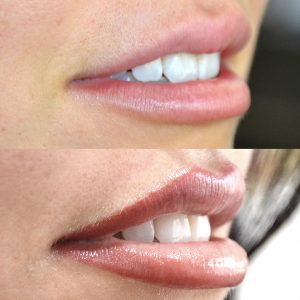 Lip Tint Tattoo before and after