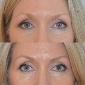 Powder eyebrow before and after
