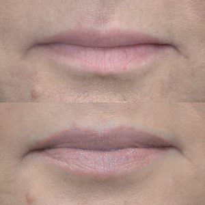 Healed Lip Tint before and after