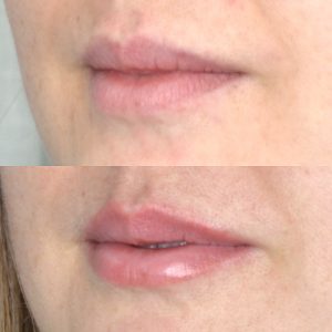 Lip Tint Tattoo healed before and after